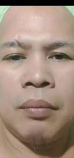 HYPERTENSION PART 1: ANO ANG HYPERTENSION? PART 2: 👉http://bit.ly/2MExYM3  Ito ang pinaka-unang post ko tungkol sa HYPERTENSION. Sa mga susunod na  post ay tatalayakin pa natin nang maigi ang sakit na ito.