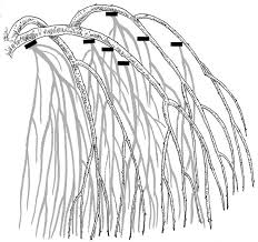 Locate and remove any small suckers growing from the side of the trunk, using hand pruners. Five Common Pruning Mistakes And How To Fix Them Finegardening