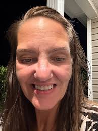 🌟 Meet Stacey's Smile Journey 🌟 I first connected with Stacey right here 