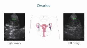 Start studying female pelvic ultrasound. How Can I Image The Female Pelvis With A Pelvic Ultrasound Youtube