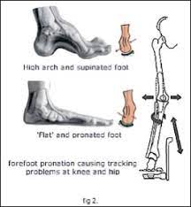 Bike Fit Nz Velo Boutique Bicycle Store Road And Triathlon Specialist Medical Therapy Orthotics And Prosthetics Feet