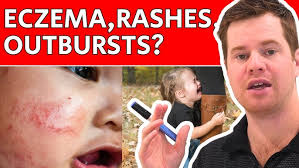 Fix Your Child's Skin & Mood Issues (Naturally!)