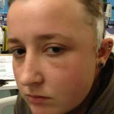 Woman's horrific head injuries after being attacked with ice skate 'for  smoking in the street'