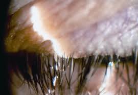 Image result for Blepharis gazensis