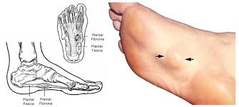 What Are Those Lumps And Bumps On My Feet Foot And Ankle Associates Of North Texas Llp Healthy Book Feet Treatment Feet Care