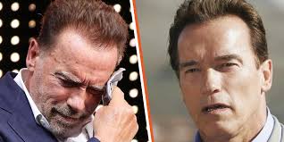 Arnold Schwarzenegger Plastic Surgery: An Overview
