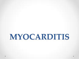 Myocarditis is an inflammation of the heart muscle that decreases the ability of the heart to pump blood normally. Myocarditis