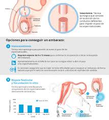 Es Posible Ser Padres Despues De Una Vasectomia Clinica Eugin