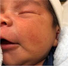 Image result for Harlequin Color Change