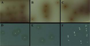 Box 6100, mississippi state, mi 39762, usa. Colonies Produced By L Monocytogenes L Ivanovii And L Innocua On Download Scientific Diagram