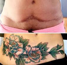 See more ideas about tummy tuck tattoo, tattoos, body art tattoos. Pin On Cool Tattoo Ideas