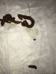 Some dogs/puppies can get diarrhea from the excitement/stress of being away and then coming. 3 6 Week Old Puppy Just Pooped Worms I Gave A Dose Of Something From The Vet For Distended Belly And He Pooped These