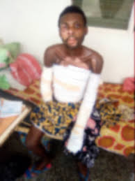 We did not find results for: Man Suffering Epilepsy Falls Into Naked Fire Family Seeks Help