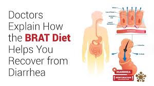How The Brat Diet Helps You Recover From Diarrhea In 2020 Brat Diet Diet Help Bland Diet