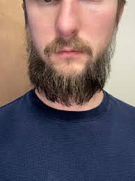 Even trimming of facial hairs show the same results. 3 Month Beard Growth I Shaved Before My First Son Was Born Three Months Ago My Plan Is To Grow A Yeard But I M Still Not Getting The Hair Growth I Want