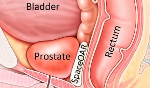 Almost always, waiting until symptoms of prostate cancer occur is too. To Avoid Prostate Cancer Men Must Have Sex At Least 21 Times A Month