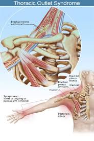 Thoracic Outlet Syndrome Symptoms Treatment Tests