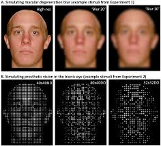 This means the simulations are not only 'wishful thinking', but surgically achievable according to the surgeon's eye. Simulations Of Facial Appearance In Low Vision A High Resolution Face Download Scientific Diagram