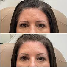 Ashley Ferguson Head MSN, FNP-C (@ashley.fineline.aesthetics) • Instagram  photos and videos