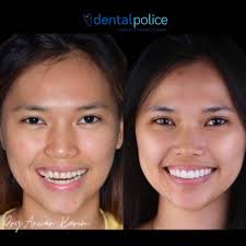 Dr. Anwar Yao Karim (@dentalpolice) • Foto dan video Instagram