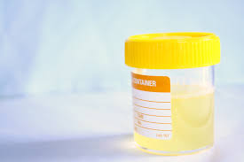 However, some underlying causes are associated with the additional symptoms that. Cloudy Urine Symptoms Causes Treatments