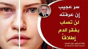 كنز جعله الله علاج دوالي الساقين ويشفي بسرعة، يقدم الدكتور مازن السقا طرق طبيعية لمحاربة الأوردة العنكبوتية علاج دوالى الساقين بالحقن هى تقنية طبية لعلاج دوالي الساقين بالإبر يتم من خلالها حقن مادة داخل الوريد المصاب. Ø¹Ù„Ø§Ø¬ ÙÙ‚Ø± Ø§Ù„Ø¯Ù… Ø§Ù„Ù„Ø§ØªÙ†Ø³Ø¬ÙŠ Ø¨Ø§Ù„Ø§Ø¹Ø´Ø§Ø¨ ÙƒÙŠÙ ØªØ¹Ø§Ù„Ø¬ ÙÙ‚Ø± Ø§Ù„Ø¯Ù… Ø¹Ù†Ø¯ Ø§Ù„Ø£Ø·ÙØ§Ù„