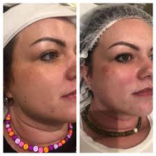 Nicole Chamberlain Aesthetics and Semi Permanent Makeup