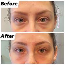 Mara Keith, Nurse Practitioner Injector