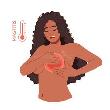 Image result for Mastalgia