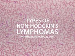Types Of Non Hodgkin S Lymphomas Non Hodgkin Cancer Help Lymphoma Cancer
