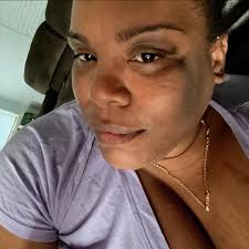 Hey, I got my belly button pierced