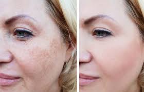 We ranked the best wrinkle creams and serums. 11 Best Beauty Services At Kaya Skin Clinic