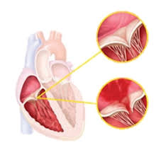 Comme vous pouvez vous en douter, je me pose quelques questions par rapport à nos disciplines. Infos Patients Cardiologie Imm Institut Mutualiste Montsouris
