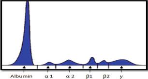 These cells are part of your immune system, which helps protect the body from germs and other harmful substances. Serum Protein Electrophoresis And Its Clinical Applications Intechopen