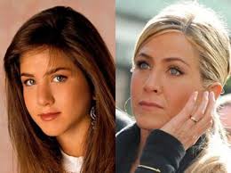 Good Plastic Surgery 7 Most Successful Celebrity Plastic Surgeries Youqueen Good Celebrity Plastic Su Celebrity Plastic Surgery Celebrity Surgery Hair Implants