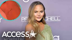 Chrissy teigen was never pregnant. Chrissy Teigen S New Tattoo For Late Son Jack Youtube