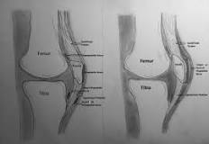 Image result for icd 10 code for prepatellar bursitis right knee