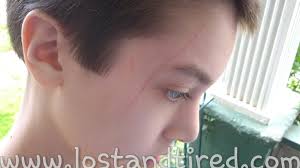 Autism: Meltdowns, Seizures and Self-Injury