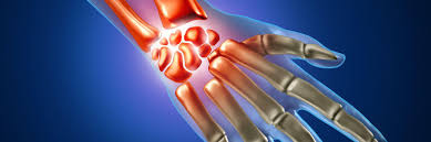A bone doctor may specialize in the spine or the feet, in adults or children, in diagnosing your bone problems or in. An Orthopaedic Surgeon Answers Your Wrist Fracture Procedure Questions Rothman Orthopaedic Institute