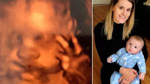 Baby stillborn after midwives failed to deliver him for 12 hours despite  concerns from mum