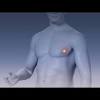 Men do not get breast cancer; 1