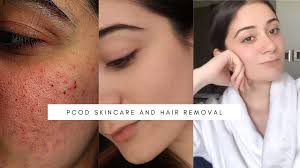 The researchers found that hair removal by shaving, using a depilatory cream, electric epilation, or in other words, we will not know for sure whether removing facial hair improves absorption of acne. My Pcod Skincare How I Got Rid Of Acne Facial Hair Youtube
