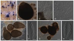 O facebook oferece às pessoas o. Plants Free Full Text Pathological Morphological Cytogenomic Biochemical And Molecular Data Support The Distinction Between Colletotrichum Cigarro Comb Et Stat Nov And Colletotrichum Kahawae Html