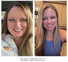 What is the best whey protein to use for fatty liver?