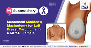 Image result for Mastectomy