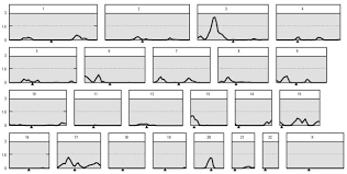 Evidence of Genetic Effects