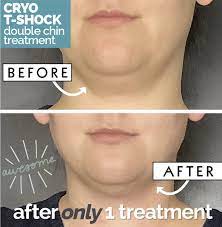 Pin On Cryo