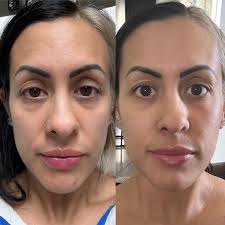 Surviving concentration camps with purpose