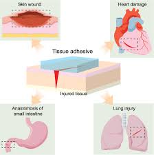 Image result for Tissue Adhesive