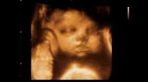 With 3d sonogram from 1st glimpse you can see your unborn baby today. Brooklyn Ny 1st Glimpse Inc 3d 4d Ultrasound